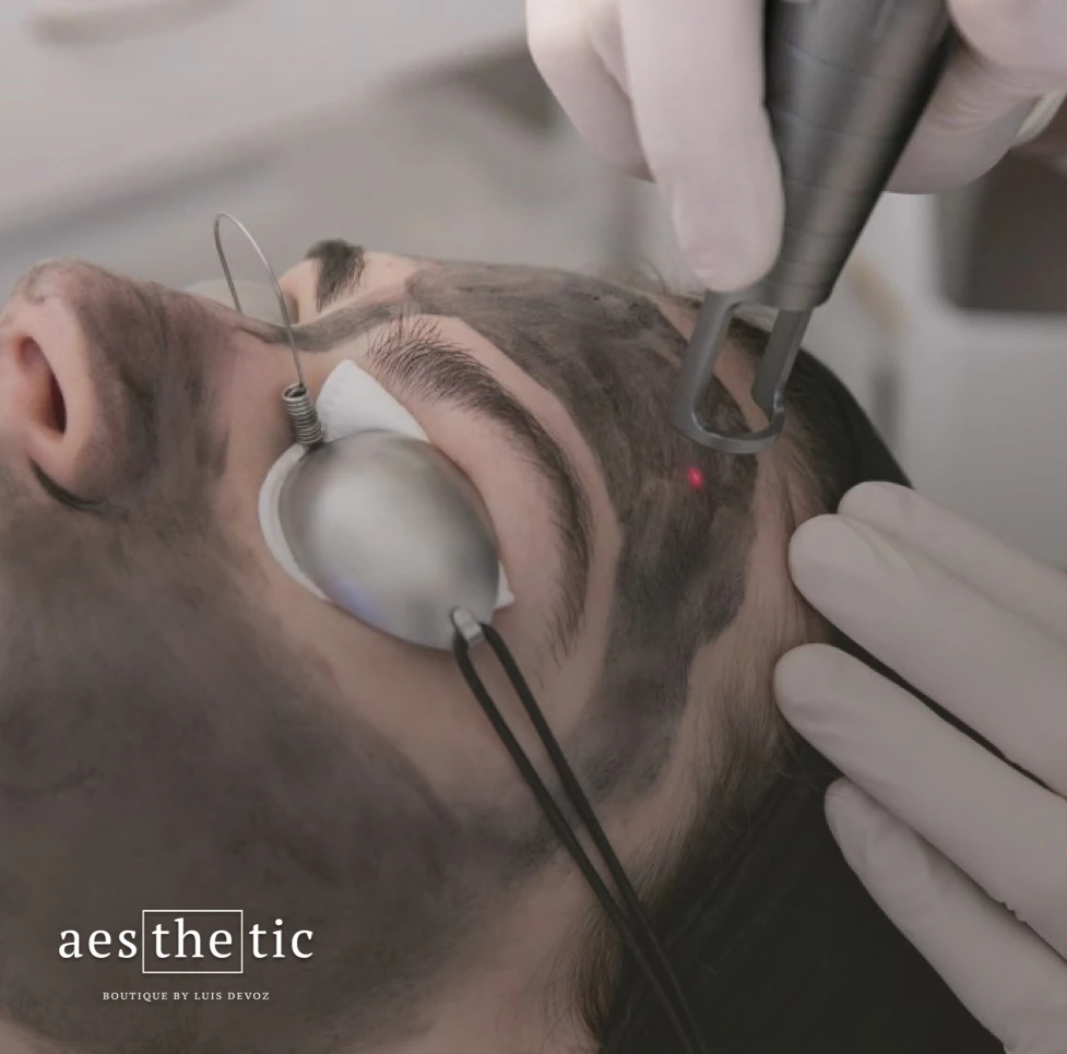 Hollywood Peel carbon laser en Bogotá - The Aesthetic